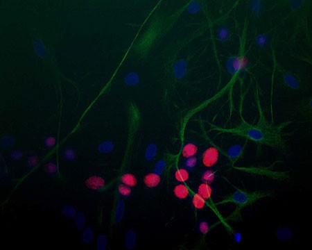Rat brain neural cultures stained with Mouse monoclonal antibody to NeuN M-377-100.jpg